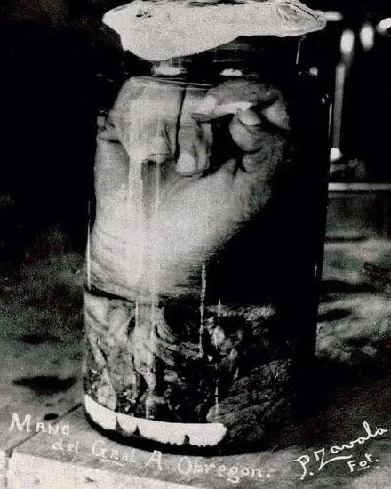 El brazo amputado de Obregón fue conservado en un frasco con formol y exhibido durante muchos años en un monumento en la Ciudad de México.